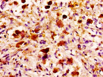MASP2 / MASP-2 Antibody