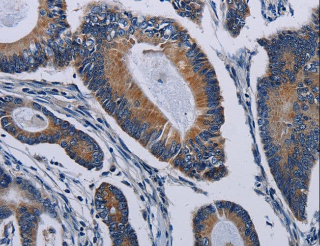 Polyclonal Rabbit anti-Human PCDHAC2 Antibody (IHC)