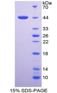Human TNNT2 / CTNT Protein (Recombinant His-GST)