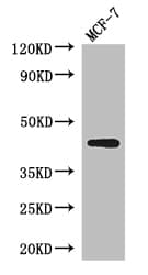 Polyclonal Rabbit anti-Human ADIPOR1/Adiponectin Receptor 1 Antibody (IHC, IF, WB)