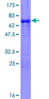 Human Piccolo Protein (Recombinant GST)