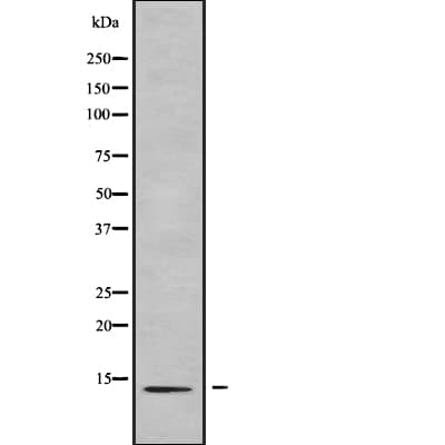Polyclonal Rabbit anti-Human CCL27 Antibody (WB)