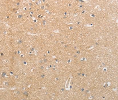 IHC-plus™ Polyclonal Rabbit anti-Human Neurofascin / NF Antibody (IHC, WB)
