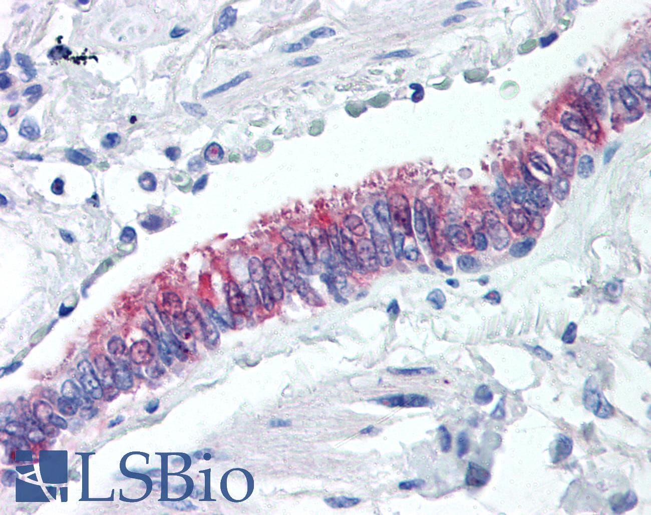 IHC-plus™ NQO1 Antibody (clone A180)