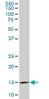 RPL36A / Ribosomal Protein L36 Antibody (clone 5F8)