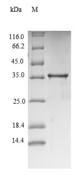 Mouse TNF Alpha Protein (Recombinant 6His-SUMO, N-terminus)