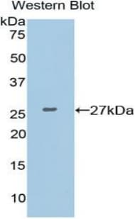 XRCC6 / Ku70 Antibody (aa397-603)