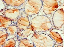 Polyclonal Rabbit anti-Human PDPK1 / PDK1 Antibody (aa277-556, IHC)