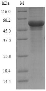 Schizosaccharomyces pombe Pos5 Protein (Recombinant 6His-SUMO, N-terminus)