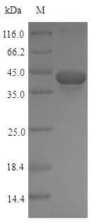 Rat TGFB1 / TGF Beta 1 Protein (Recombinant 6His-SUMO, N-terminus)