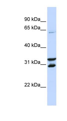 FBXO24 Antibody (aa72-131)