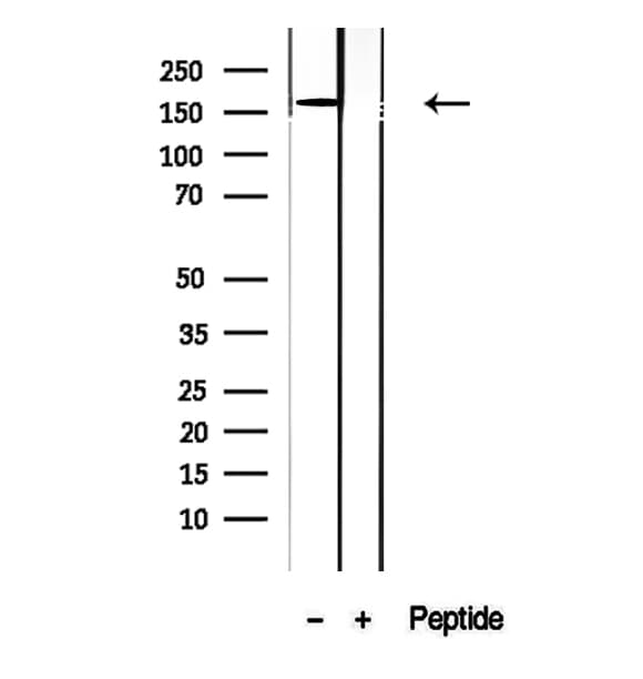 Polyclonal Rabbit anti-Human CPS1 Antibody (IHC, IF, WB)