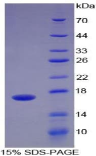 Human ADAMTS4 Protein (Recombinant His)