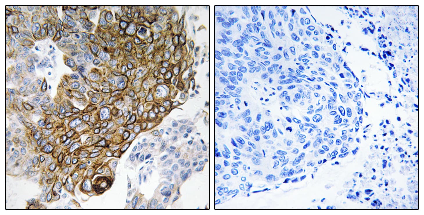 GJA3 / CX46 / Connexin 46 Antibody (aa151-200)