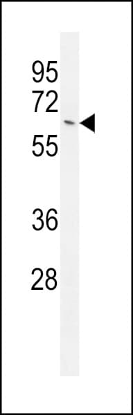 NKPD1 Antibody (aa532-560)