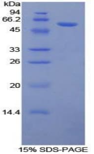 Human NR3C1/Glucocorticoid Receptor Protein (Recombinant His-GST)