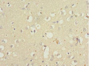 QKI Antibody