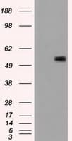 CD36 Antibody (clone OTI3F4)