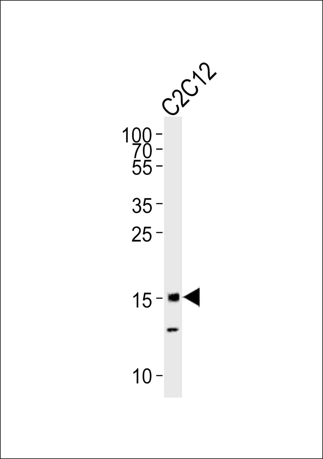 Polyclonal Rabbit anti-Human HIST1H3A Antibody (WB)