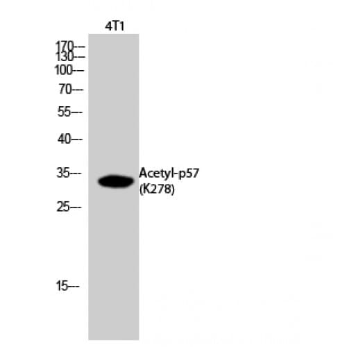 Polyclonal Rabbit anti-Human CDKN1C / p57 Kip2 Antibody (acetylation site of K278., WB)