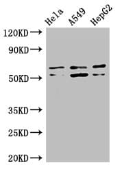 ADCK4 Antibody