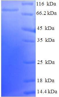 Human p56lck / LCK Protein (Recombinant His-SUMO)
