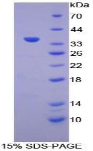Human ATP6AP2 / Renin Receptor Protein (Recombinant His-T7)