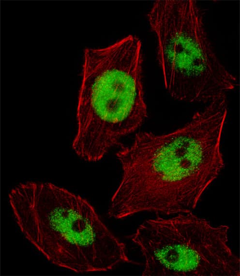 PHOX2B Antibody (aa104-130)