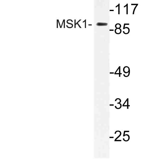 Polyclonal Rabbit anti-Human RPS6KA5 / MSK1 Antibody (Asp205, IHC, WB)