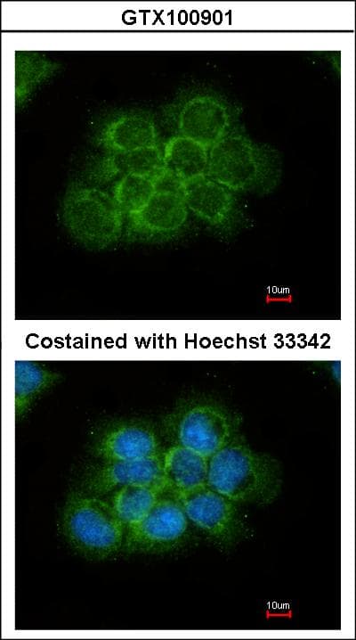 Polyclonal Rabbit anti-Human CRK Antibody (IF, WB)