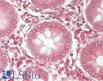 IHC-plus™ Monoclonal Mouse anti-Human APMAP / C20orf3 Antibody (clone OTI4F6, IHC, WB)
