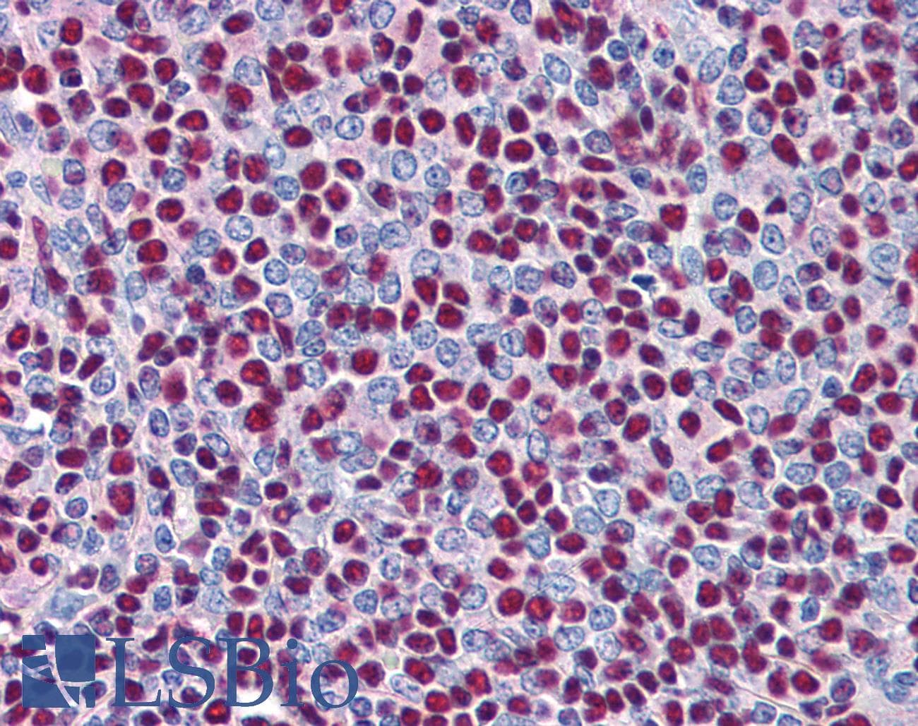 IHC-plus™ XRCC5 / Ku80 Antibody (aa462-475)