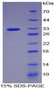 Human PLG / Plasmin / Plasminogen Protein (Recombinant His)