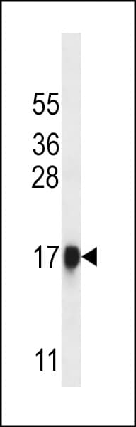 CELA1 / Pancreatic Elastase 1 Antibody (aa51-79)