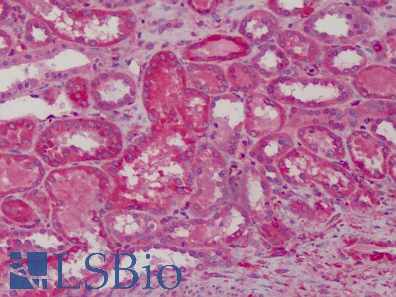 IHC-plus™ Polyclonal Rabbit anti-Human MAD2L1 / MAD2 Antibody (IHC, WB)