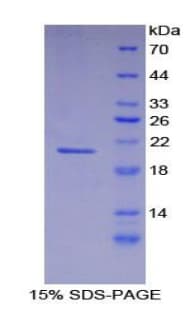Mouse FBN1 / Fibrillin 1 Protein (Recombinant His)