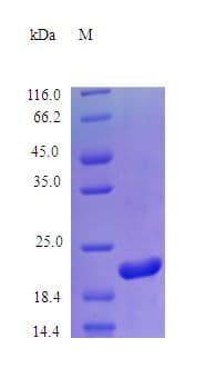 Mouse PRL / Prolactin Protein (Recombinant)