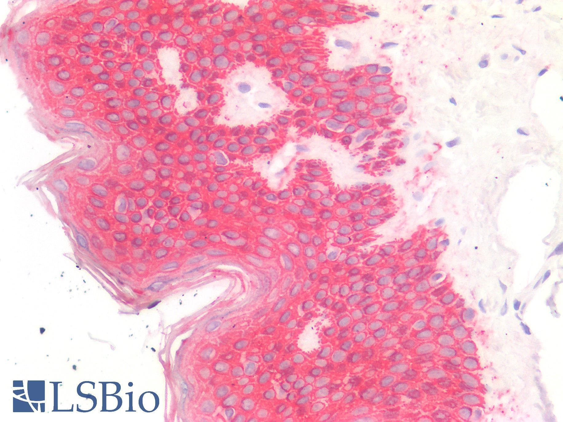 PathPlus™ Polyclonal Guinea pig anti-Human Pan Cytokeratin Antibody (IHC, WB)