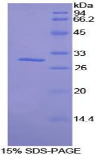 Mouse SIK2 / SNF1LK2 Protein (Recombinant His-T7)