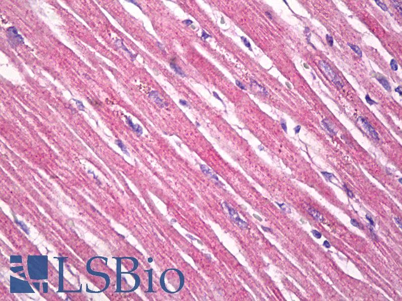 IHC-plus™ TPM3 Antibody (clone 2E4)