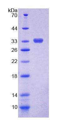 Human CHIT1 / Chitotriosidase Protein (Recombinant His-T7)