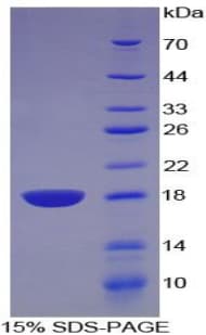 Rat ARTN / Artemin Protein (Recombinant His-T7)