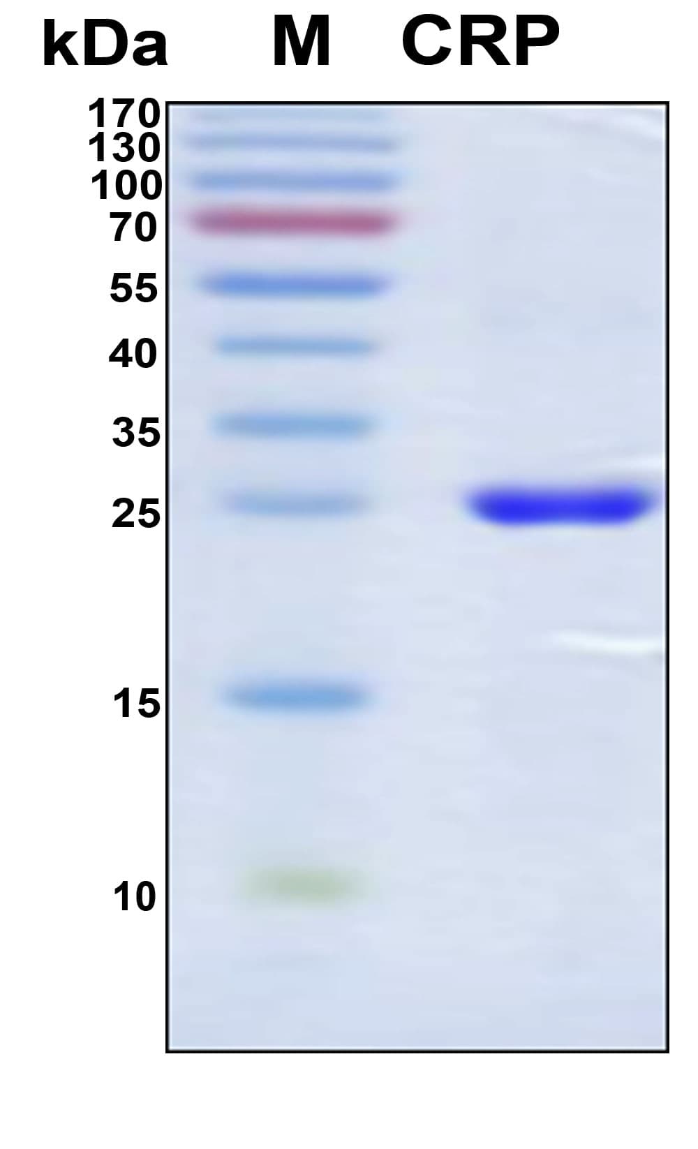 Human CRP / C-Reactive Protein (Recombinant 6His, N-terminus)