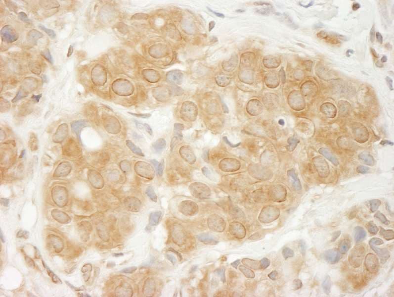 Polyclonal Rabbit anti-Human GIT1 Antibody (aa600-650, IHC)