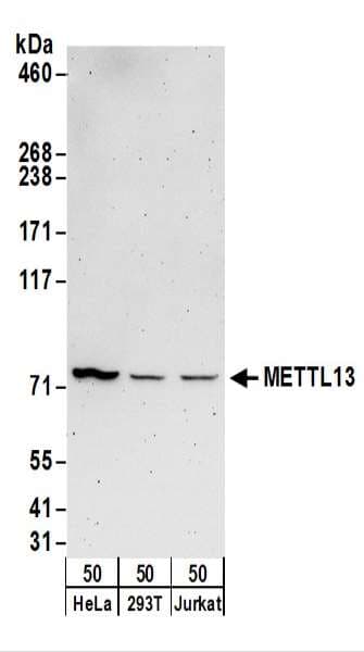METTL13 / KIAA0859 Antibody (aa1-50)