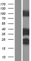 TPM3 Protein (Over-Expression Lysate Myc-DDK (Flag))