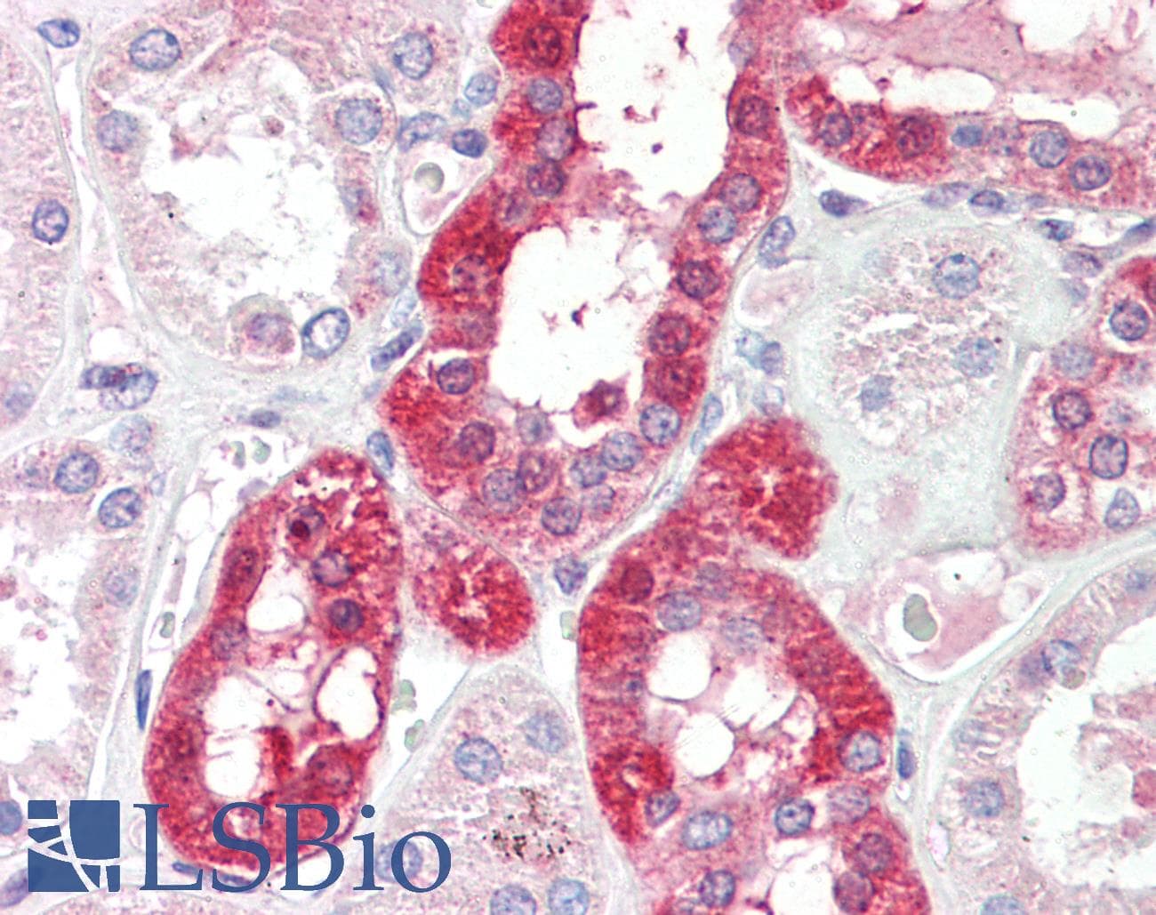 PathPlus™ SLC6A8 Antibody (aa212-226)