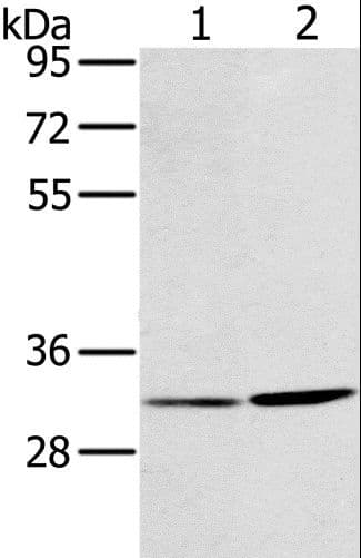 Polyclonal Rabbit anti-Human HSD17B12 Antibody (IHC, WB)
