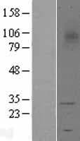 TREM1 Protein (Over-Expression Lysate Myc-DDK (Flag))