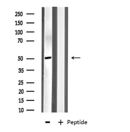 MYLIP / IDOL Antibody